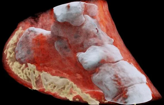 Spectral 3D X-ray image of a bone structure